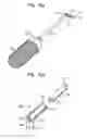 Fig. 19 - System and method for joint resurface repair