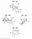 Fig. 22 - System and method for joint resurface repair
