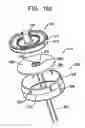Fig. 25 - System and method for joint resurface repair