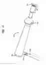 Fig. 58 - System and method for joint resurface repair