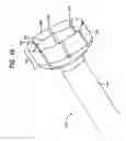 Fig. 62 - System and method for joint resurface repair