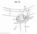 Fig. 66 - System and method for joint resurface repair
