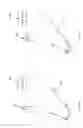 Fig. 109 - Robotic catheter system