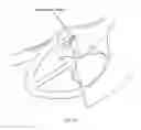 Fig. 130 - Robotic catheter system