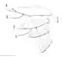 Fig. 134 - Robotic catheter system