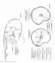 Fig. 135 - Robotic catheter system