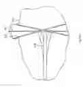 Fig. 139 - Robotic catheter system