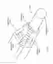 Fig. 147 - Robotic catheter system