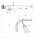 Fig. 148 - Robotic catheter system