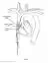 Fig. 156 - Robotic catheter system