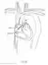 Fig. 157 - Robotic catheter system