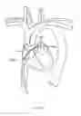 Fig. 158 - Robotic catheter system