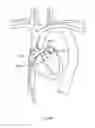 Fig. 159 - Robotic catheter system