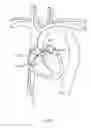 Fig. 160 - Robotic catheter system
