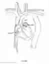 Fig. 161 - Robotic catheter system