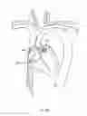 Fig. 162 - Robotic catheter system