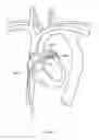 Fig. 163 - Robotic catheter system
