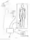 Fig. 164 - Robotic catheter system