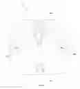 Fig. 42 - Robotic catheter system