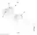 Fig. 61 - Robotic catheter system