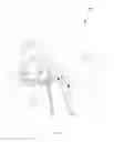 Fig. 64 - Robotic catheter system