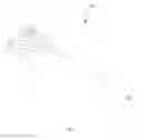 Fig. 71 - Robotic catheter system