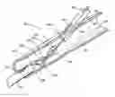 Fig. 01 - Suture loop closure device