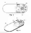 Fig. 03 - Suture Straightening Device and Method