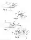 Fig. 04 - Suture Straightening Device and Method