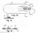 Fig. 07 - Suture Straightening Device and Method