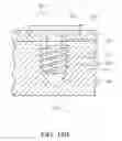 Fig. 19 - Device for fixing soft tissue
