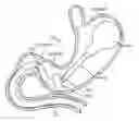 Fig. 01 - Intragastric implant devices
