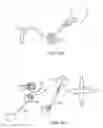 Fig. 04 - Intragastric implant devices