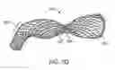Fig. 08 - Intragastric implant devices