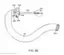 Fig. 15 - Intragastric implant devices