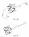 Fig. 17 - Intragastric implant devices