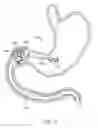 Fig. 20 - Intragastric implant devices