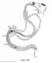 Fig. 29 - Intragastric implant devices