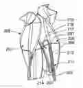 Fig. 01 - TISSUE-ACQUISITION AND FASTENING DEVICES AND METHODS