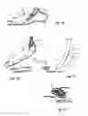 Fig. 03 - TISSUE-ACQUISITION AND FASTENING DEVICES AND METHODS