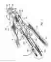 Fig. 02 - Anastomosis instrument and method for performing same