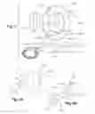 Fig. 03 - Remotely adjustable tissue displacement device