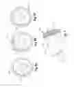 Fig. 05 - Remotely adjustable tissue displacement device