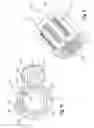 Fig. 08 - Remotely adjustable tissue displacement device