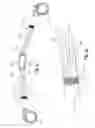 Fig. 14 - Remotely adjustable tissue displacement device