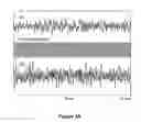 Fig. 05 - System and method for predicting successful defibrillation for ventricular fibrillation cardiac arrest