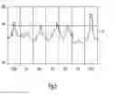 Fig. 04 - Self-calibrating rate-adaptive pacemaker
