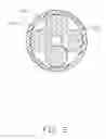 Fig. 03 - Electronic pacemaker and pacemaker lead