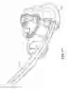 Fig. 12 - Ear implant electrode and method of manufacture
