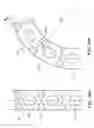 Fig. 13 - Ear implant electrode and method of manufacture